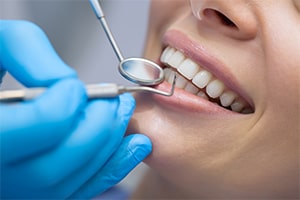 dental cleaning in dentist office for sale